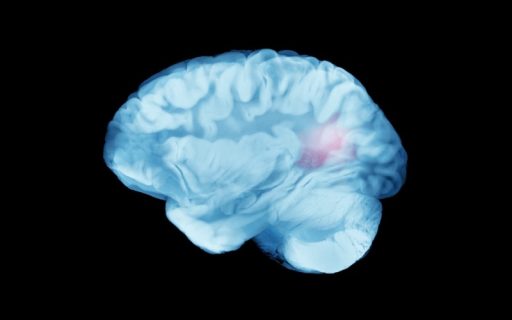 AllergoOncology: Lessons Learned from the Allergy-Glioblastoma Connection