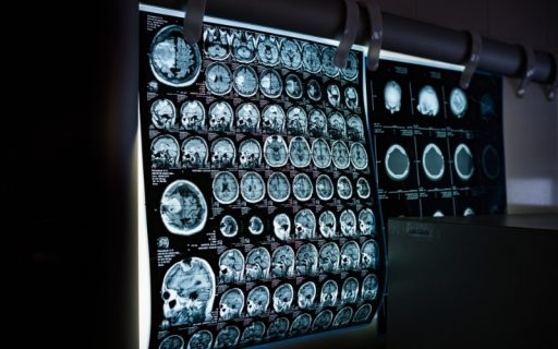 Beyond Glioblastoma - WPD Pharmaceuticals