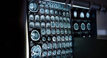 Beyond Glioblastoma - WPD Pharmaceuticals