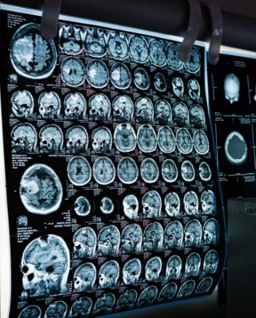 Beyond Glioblastoma - WPD Pharmaceuticals