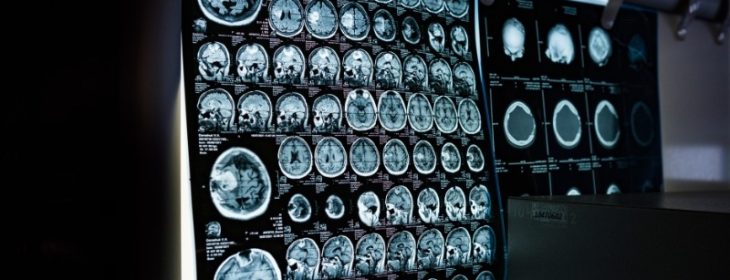 Beyond Glioblastoma - WPD Pharmaceuticals