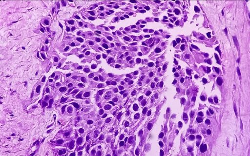 JJP-1008 as a Novel Checkpoint Inhibitor