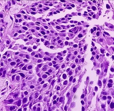 JJP-1008 as a Novel Checkpoint Inhibitor