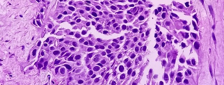 JJP-1008 as a Novel Checkpoint Inhibitor